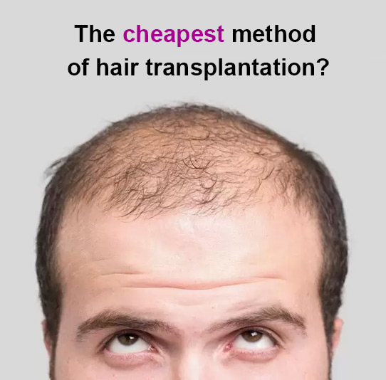 Hair transplantation cost in 2022 | Iran