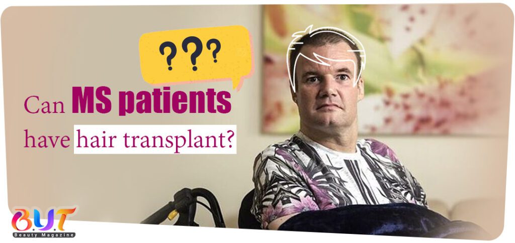 Can MS patients have hair transplant?
