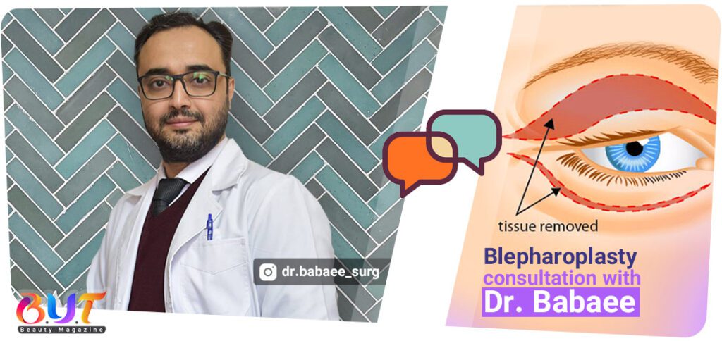 blepharoplasty dr babaee